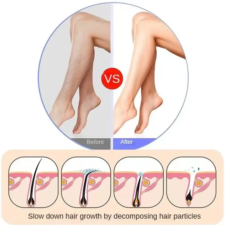 Crystal Hair Removal - 3