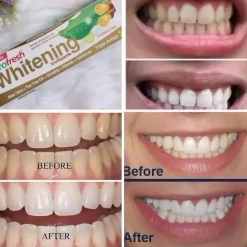 Eurofresh Whitening 112gr - 2