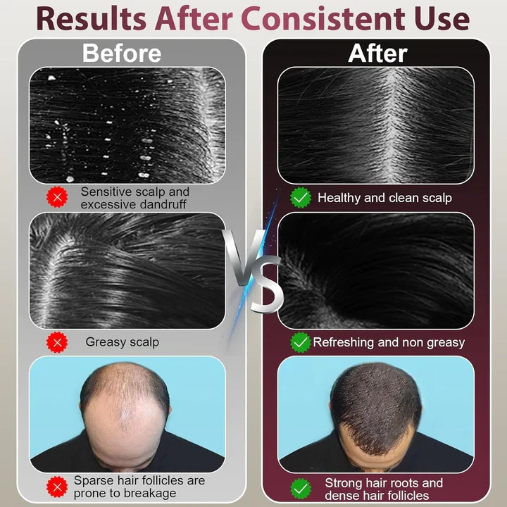 Laser Therapy Hair Growth Comb – Electric Scalp Massager & Hair Oil Applicator Waterproof - 5