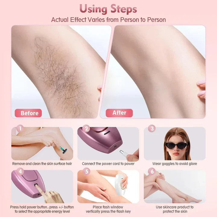 IPL Hair Removal Devices, Hair Removal, Laser Permanent Hair Removal, Laser Hair Remover - 8