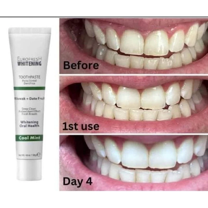 Eurofresh Whitening Miswak & Date Fruit - 2