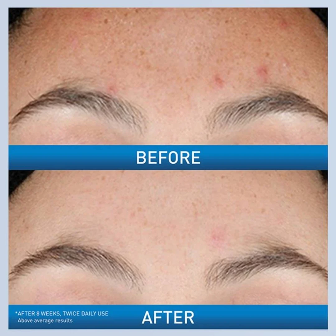 CeraVe Resurfacing Retinol Serum For Post-Acne Marks 30ml - 3